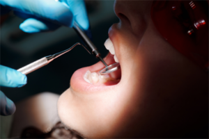 A person is getting their teeth cleaned by an dentist.