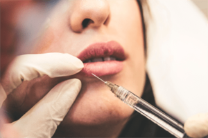 A woman getting her lips filled with botox.