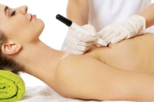 A woman getting her breast waxed by an esthetician.